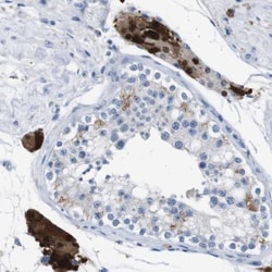 Glucose Transporter GLUT8 Antibody, Novus Biologicals:Antibodies:Primary